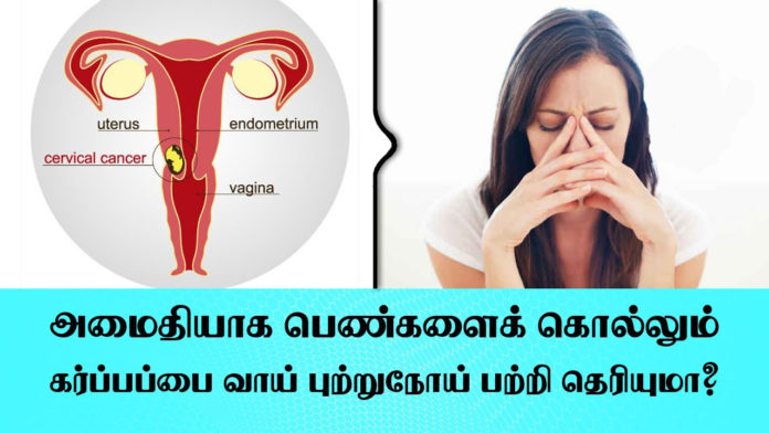கருப்பைவாய் புற்றுநோய்(cervical cancer)