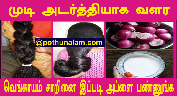 முடி அடர்த்தியாக வளர வெங்காயம் சாறு..! Onion juice for hair in tamil..!