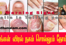 nail symptoms disease in tamil