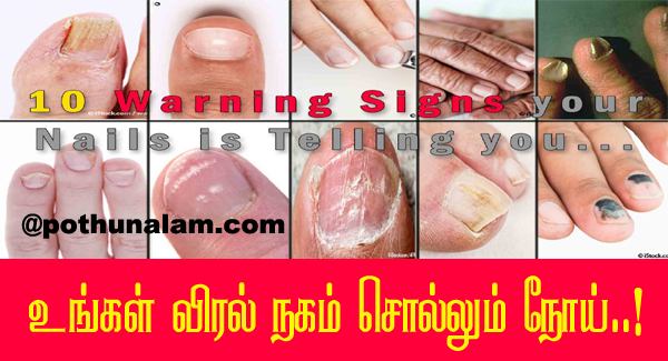 nail symptoms disease in tamil