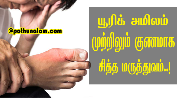 uric acid treatment in tamil