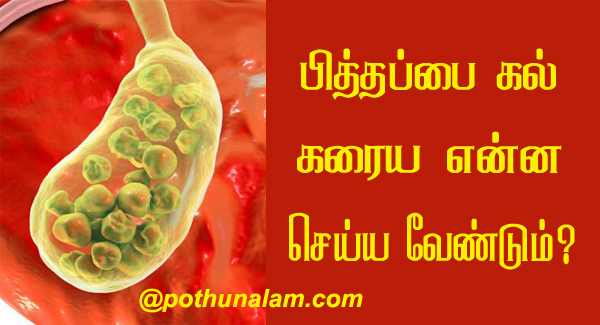 Home Remedies for Gallstones in Tamil