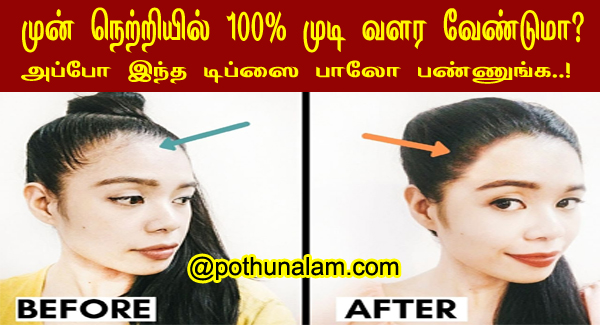 how to grow back a fuller hairline in tamil