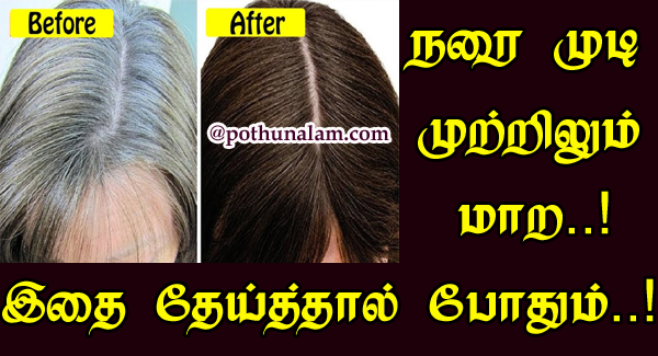 White hair Problem Solution In Tamil