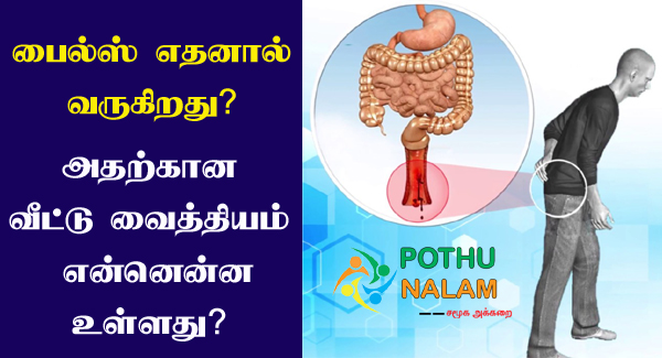 Piles Treatment in Tamil