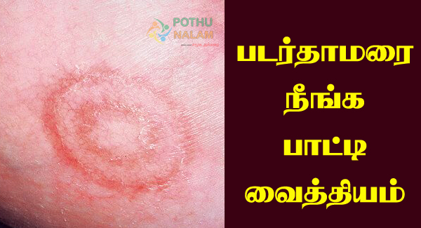 Padarthamarai Natural Treatment in Tamil