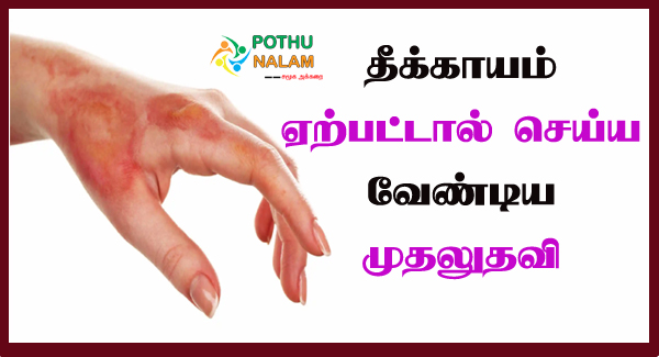 Fire Accident First Aid in Tamil