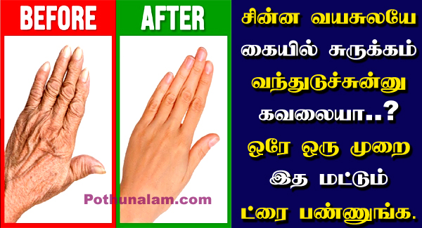 Wrinkles Hands Home Remedy in Tamil