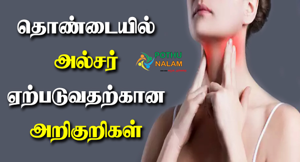 Throat Ulcer Symptoms in Tamil