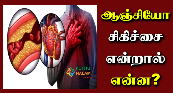 Angiogram in Tamil