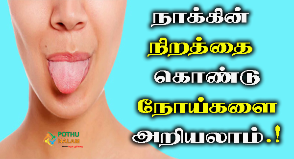 tongue colour symptoms in tamil