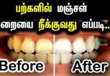 teeth whitening tips in tamil