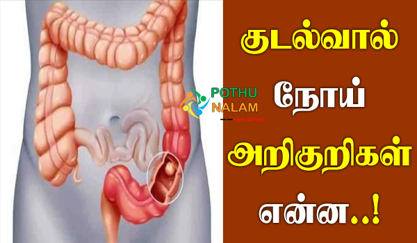 Appendix Symptoms in tamil