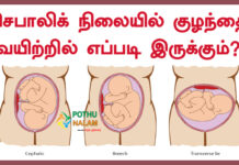 Cephalic Position Tamil