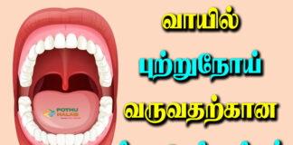 mouth cancer symptoms in tamil