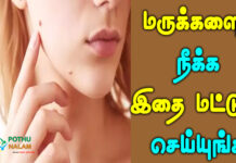 mugathil maru neenga tips in tamil