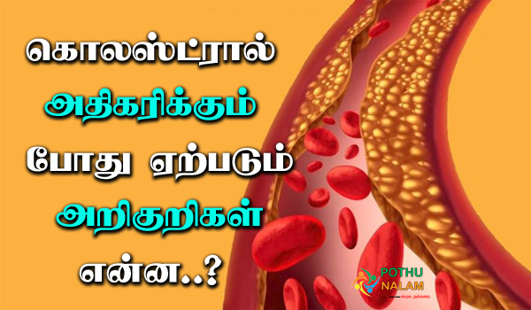 symptoms of cholesterol in tamil