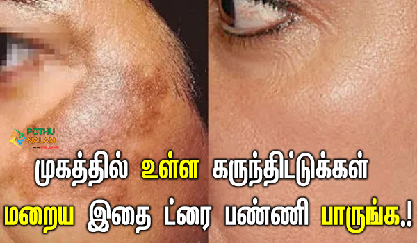 pigmentation treatment in tamil