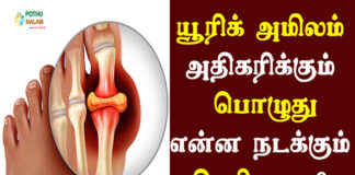 uric acid symptoms in tamil