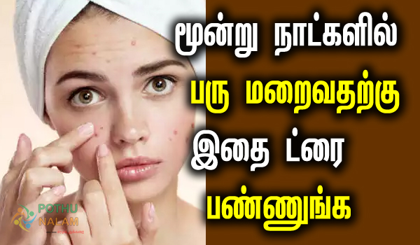 pimples remove tips in tamil