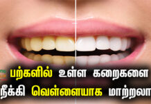 teeth whitening at home in tamil
