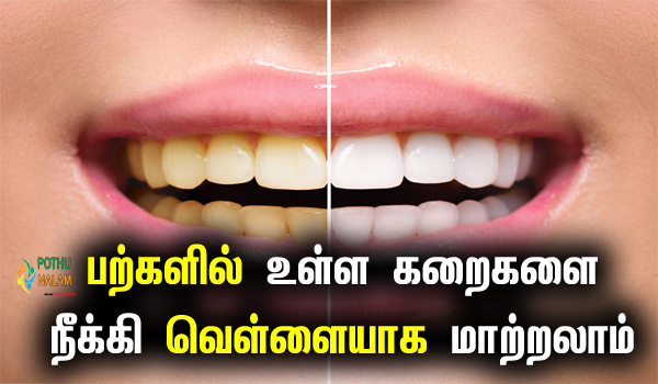 teeth whitening at home in tamil