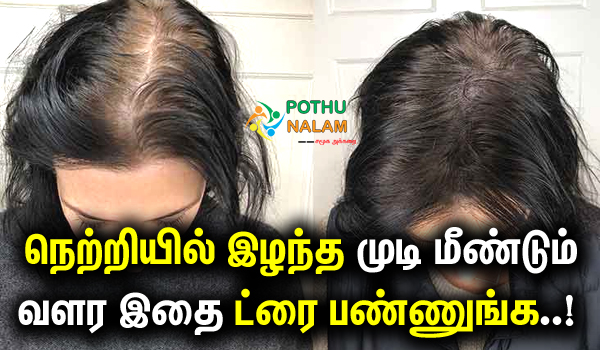 Hair Growth Oil Tips in Tamil