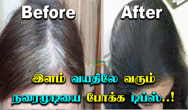 இளம் வயதிலேயே நரைமுடி வருகிறதா கவலைவேண்டாம் இந்த டிப்ஸ் மட்டும் போதும்..! |  Home Remedies for Grey Hair in Tamil