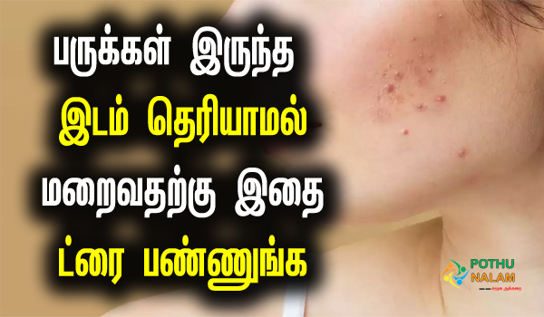 pimple remove at home tips in tamil
