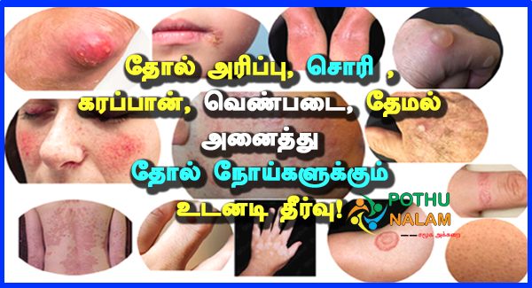 skin problems treatment in tamil