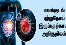 Colorectal Cancer Symptoms in Tamil