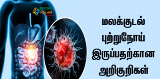 Colorectal Cancer Symptoms in Tamil