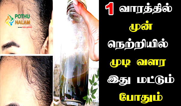 How to Grow Hair in Front Head Naturally in Tamil