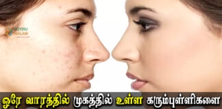 How to Remove Dark Spots on Face Fast Naturally in Tamil