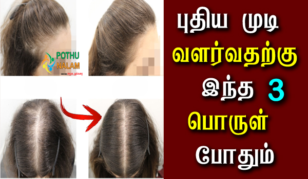 New Baby Hair Growth in Tamil