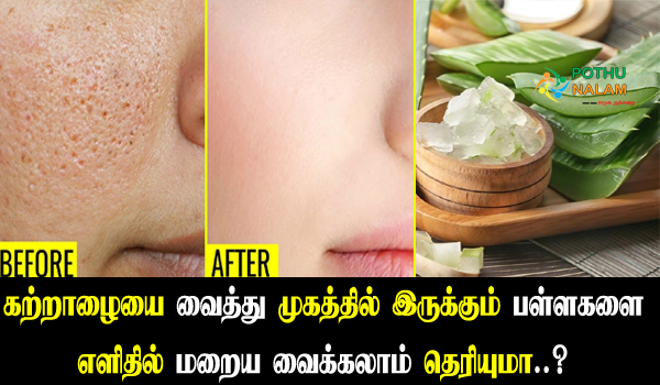 aloe vera for open pores on face in tamil