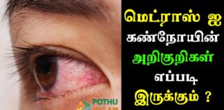 madras eye symptoms in tamil