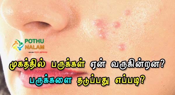 reason for pimples on face in tamil