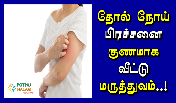 skin diseases treatment at home in tamil