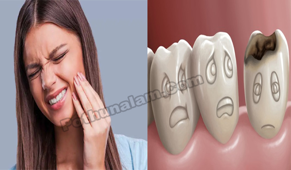 Cavity Problem Solution in Tamil
