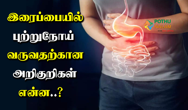 Gastric Cancer Symptoms in Tamil
