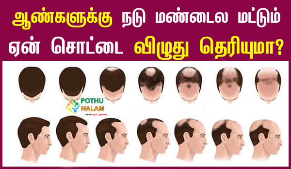 Hair Loss Reasons for Male Tamil