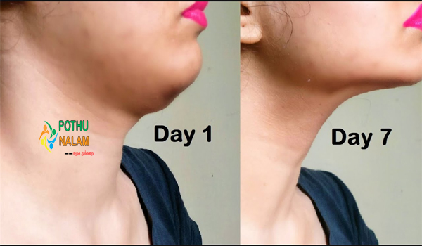 How to Reduce Neck Fat by Yoga in Tamil