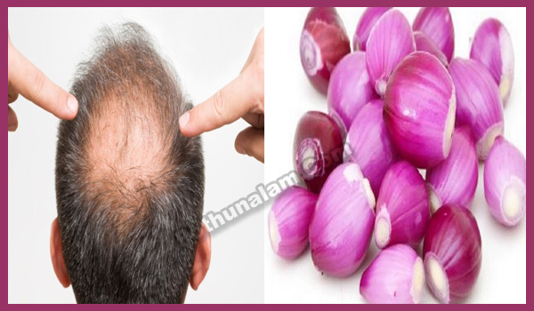 How to Regrow Hair on Bald Spot Fast in Tamil