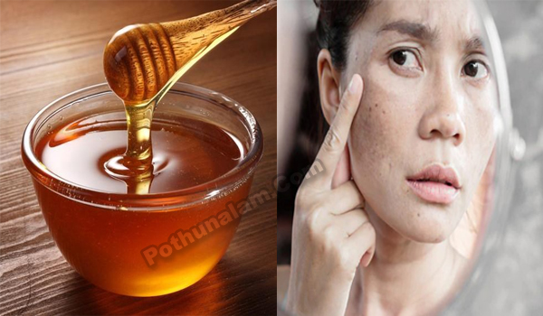 How to Remove Dark Spots on Face Fast at Home in Tamil