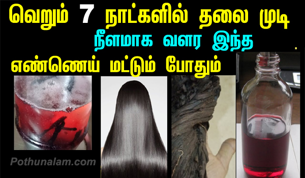 இந்த 'ஜூஸ்'களை குடிச்சா போதுமாம்... உங்க முடி கொட்டாம...நீளமா பளபளன்னு  வளருமாம் தெரியுமா? | These delicious juices can promote hair growth in tamil  - Tamil BoldSky