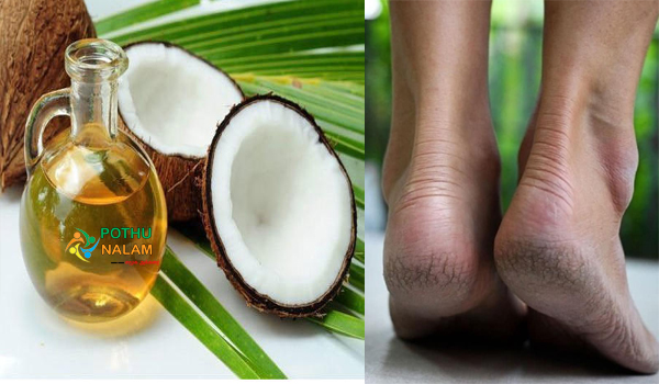 coconut oil for cracked heels in tamil