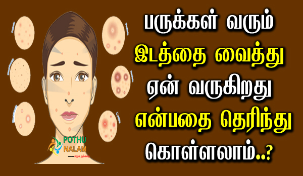 types of pimples on face and reasons in tamil