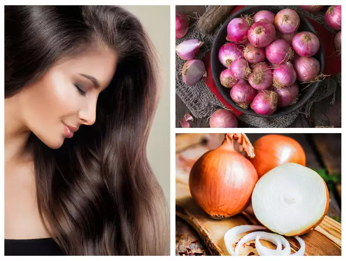 Can Onion Juice Stop Hair Loss