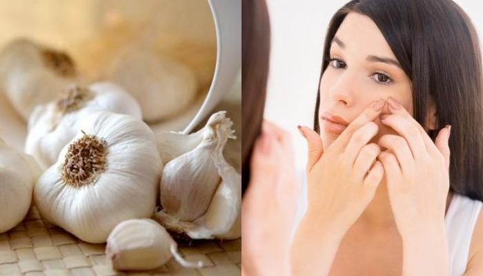 Garlic uses for skin in tamil